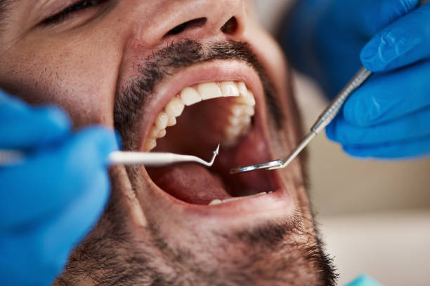 Best Cracked Tooth Emergency Dentist  in Springs, NY